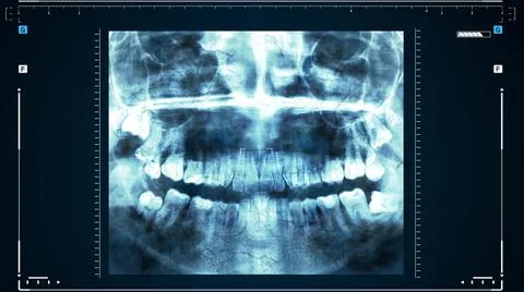 X-ray of human teeth or research on dental health. The doctor examines the Stock Illustration