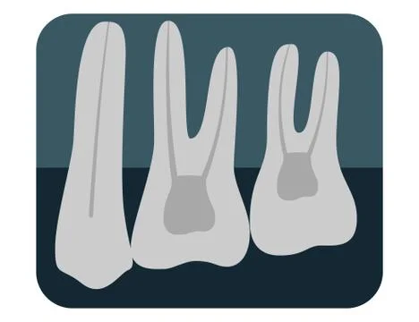 X-ray of human teeth. Three healthy molars on an x-ray. Vector illustration. Illustrazione stock