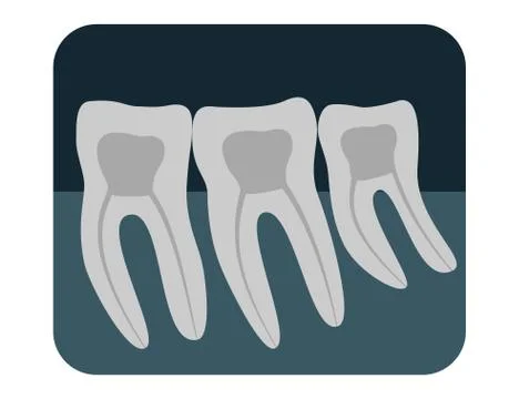 X-ray of human teeth. Three healthy molars on an x-ray. Vector illustration. Stock Illustration