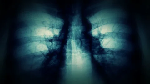 X-Ray. Human x-ray scan Video stock 33870304