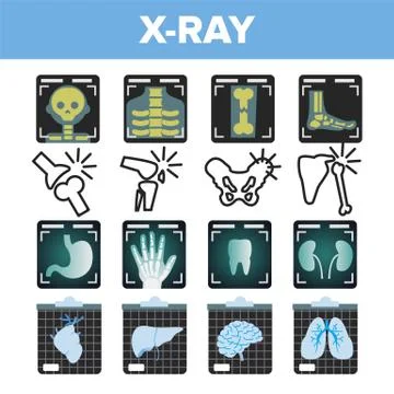 X-ray Icon Set Vector. Radiology Scan. Broken Human Bone. Medical Symbol Stock Illustration