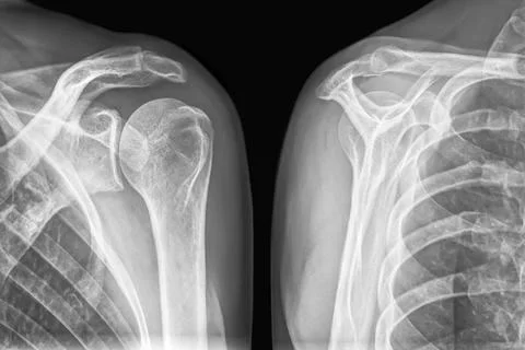X-ray image of front and back view of a female healthy body. Xray image of... Stock Photos