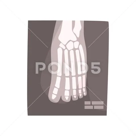 X ray image of human foot cartoon vector Illustration Stock Illustration