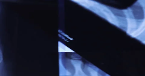 X-ray image of human knee. Problems with bone or joint. Stock-Footage 233333323