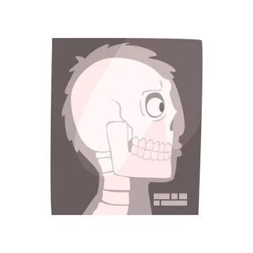 X ray image of a human skull cartoon vector Illustration Stock Illustration