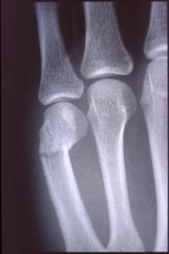 X-ray image, man, hand with bones and joints Stock Photos