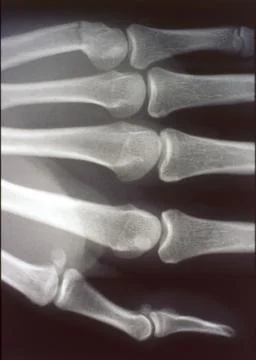X-ray image, man, hand with bones and joints Stock Photos