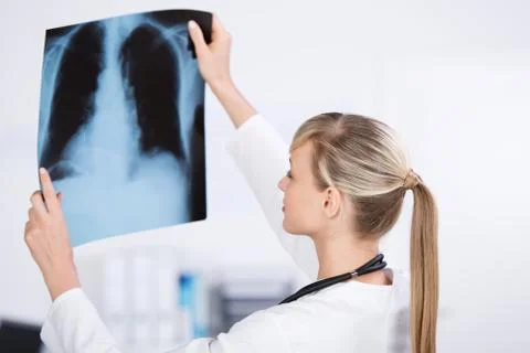 X-ray image Stock Photos