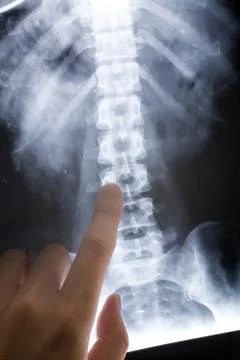X-ray image Stock Photos