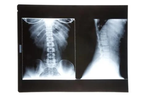 X-ray image Foto stock