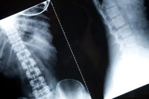 X-ray image Stock Photos