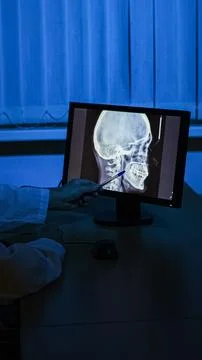X-ray image Stock Photos
