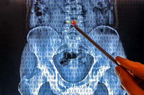 X ray image of a spine with binary code 스톡 사진