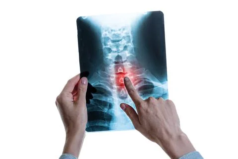 X-ray image of vertebral column with red pain point in cervical spine Stock Photos