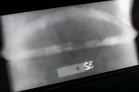 X-ray image of a welded joint of a process pipeline at an oil and chemical plant Stock Photos