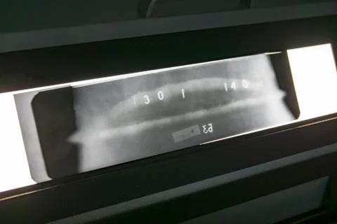 X-ray image of a welded joint of a process pipeline at an oil and chemical plant Stock Photos