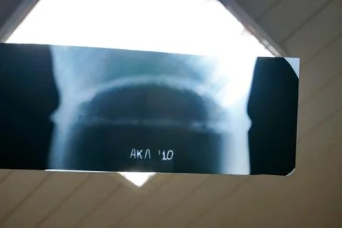 X-ray image of a welded joint of a process pipeline at an oil and chemical pl Stock Photos