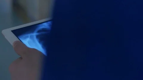 X-ray images on the tablet screen 스톡 동영상 75131844