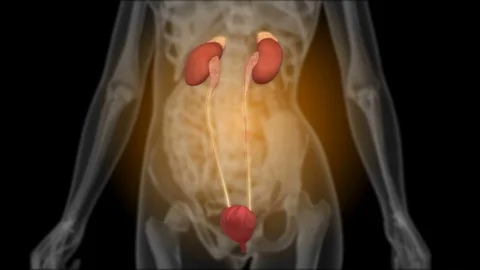 X-ray of the kidneys Stock-Footage 74106764