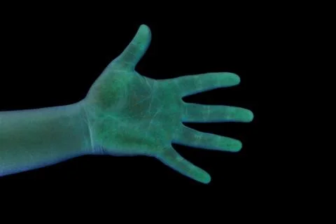 X-ray of the left hand Stock Photos