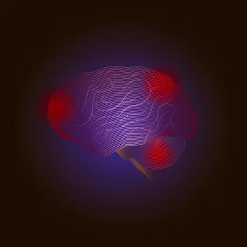 X-ray line Vector Medical illustration. Diseases of the brain with points of  Stock-Illustration