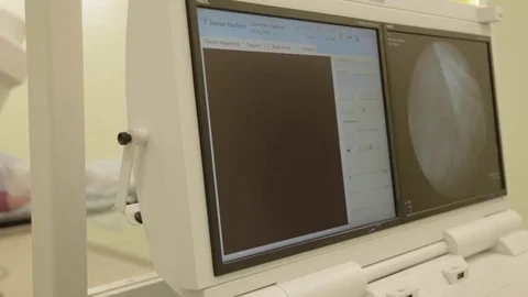 X-ray lithotriptor screens Stock Footage 81284087