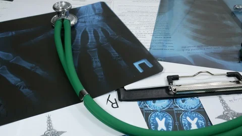 X-ray of the lungs and hands on the doctor's desk in the hospital Stock Footage 87358689