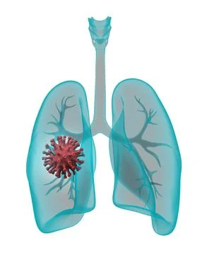 X-ray lungs with coronavirus molecule Stock Illustration
