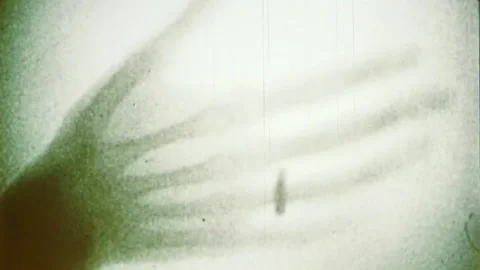 X-ray machine Stock Footage 159437204