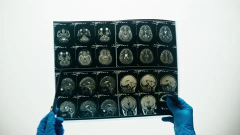 X-ray, Magnetic resonance image of head. Doctor examining human brain MRI close Stock Footage 169199041