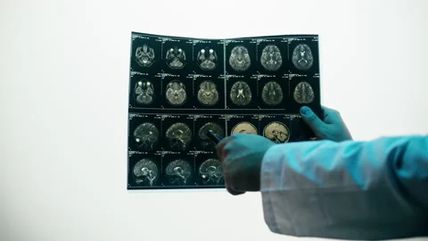 X-ray, Magnetic resonance image of head. Doctor examining human brain MRI close Stock Footage 169199149