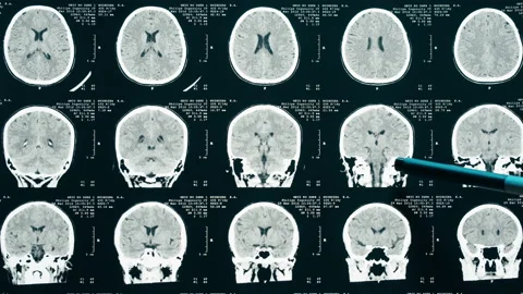 X-ray, Magnetic resonance image of head. Doctor examining human brain MRI close Stock Footage 169199197