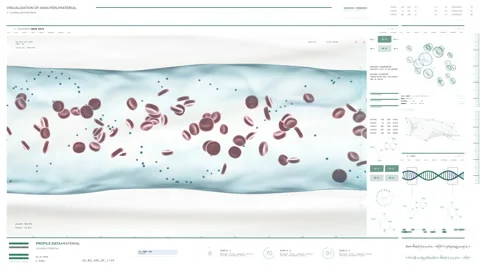 X-ray medical scanner identifies the AB Blood Type after the vein examination Stock Footage 216807528