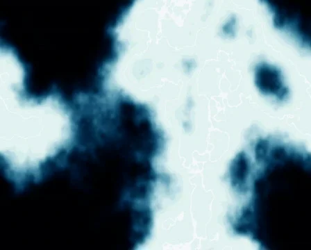 X-Ray Move Video stock 102797