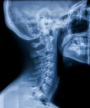 X-ray of the neck Stock Photos