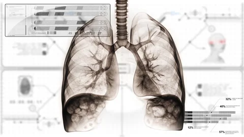 X-ray perspective style dynamic video footage of human organs and skeletons Video stock 319969365