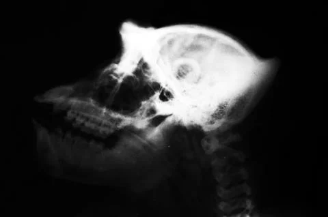 X-ray Stock Photos