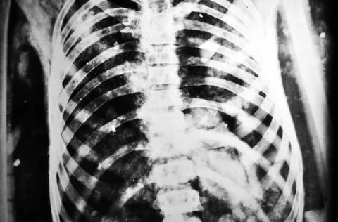 X-ray Stock Photos