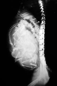 X-ray Stock Photos