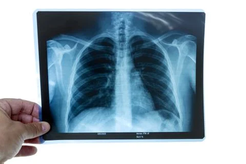 X-ray Stock Photos