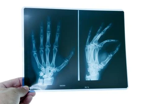 X-ray Stock Photos