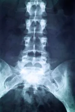 X-ray Stock Photos