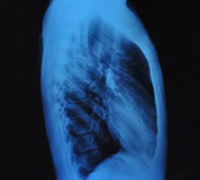 X-ray Stock Photos
