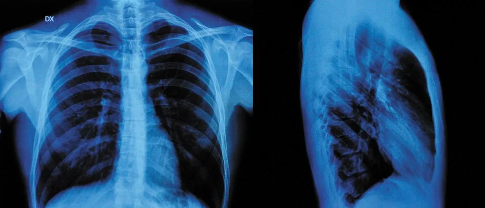 X-ray Stock Photos