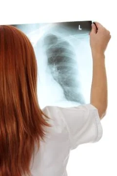 X-ray Stock Photos