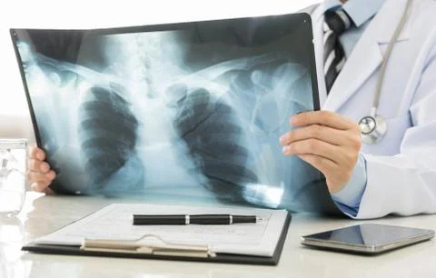 X-ray Stock Photos