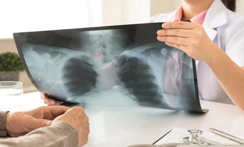 X-ray Stock Photos