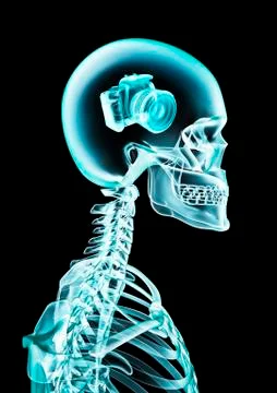 X-ray photographic memory Ilustração Stock