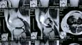 X-ray picture HD Footage