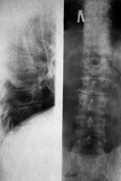 X-ray picture Stock Photos